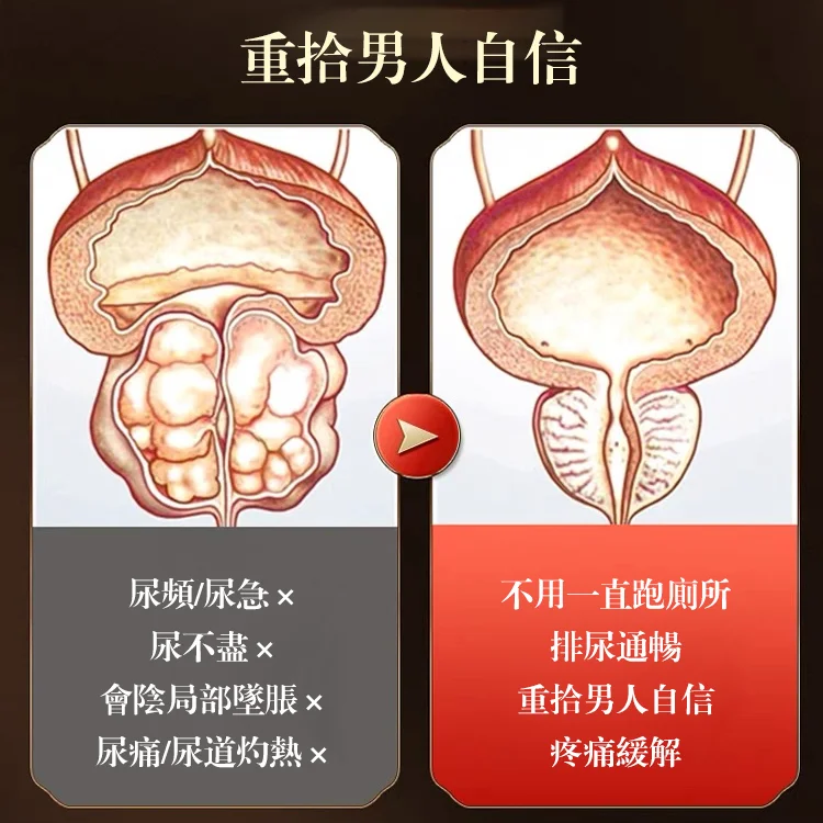 速勃力遠紅外攝護腺理療貼 速勃力遠紅外攝護腺理療貼